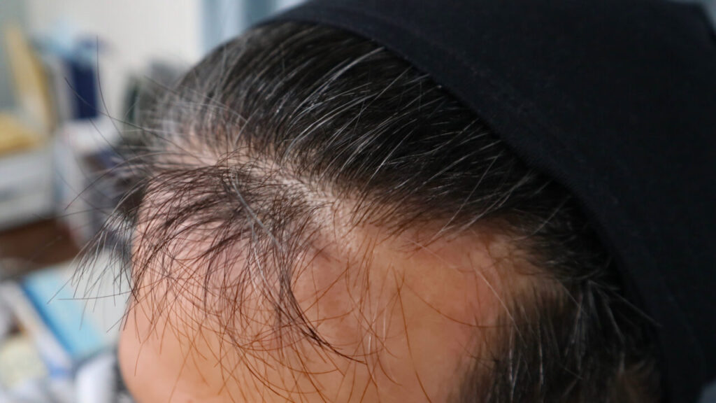 左側：2026年２月